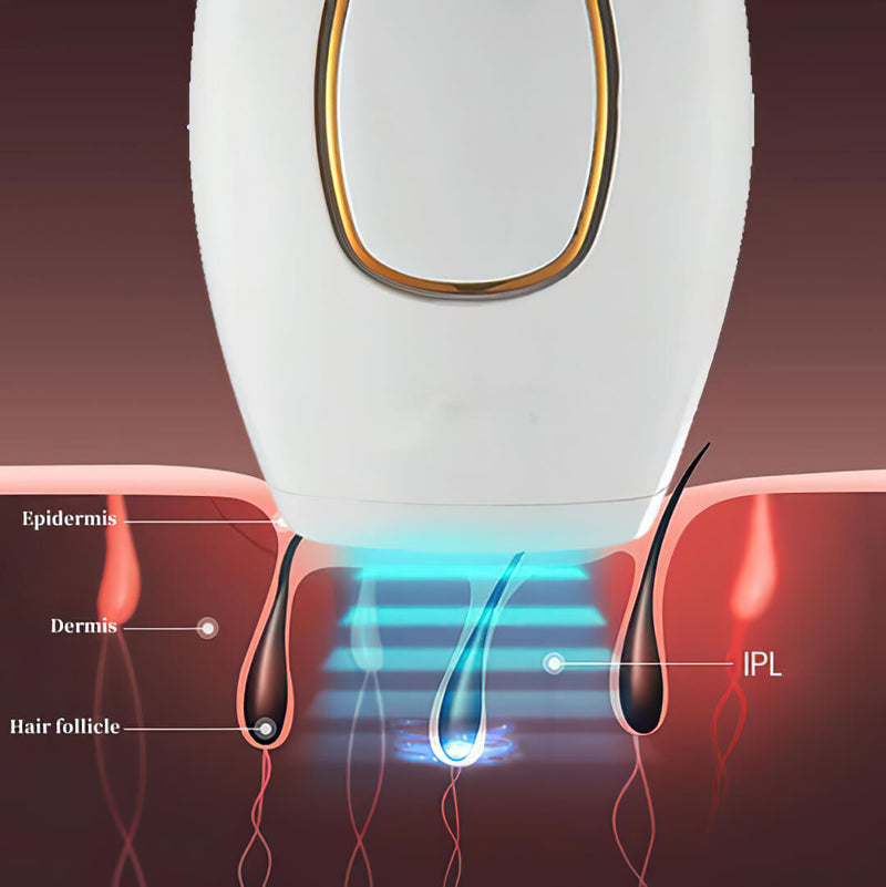 Depilador a Laser Venus Flash Indolor - FRETE GRÁTIS